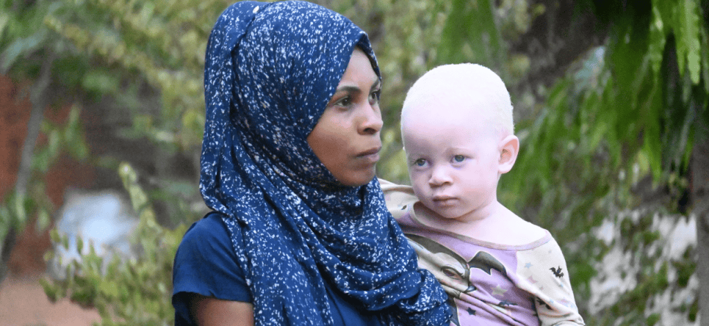 Tanzanian mother in blue headscarf holds her baby who has albinism